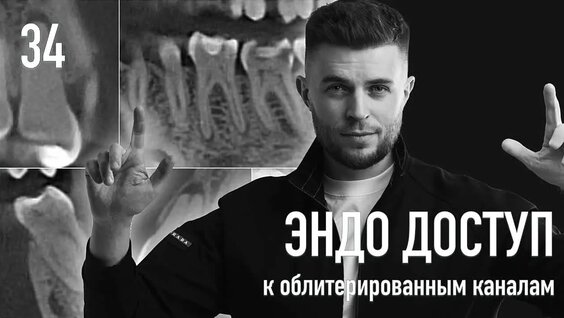 Дмитрий Николаев VK Видео