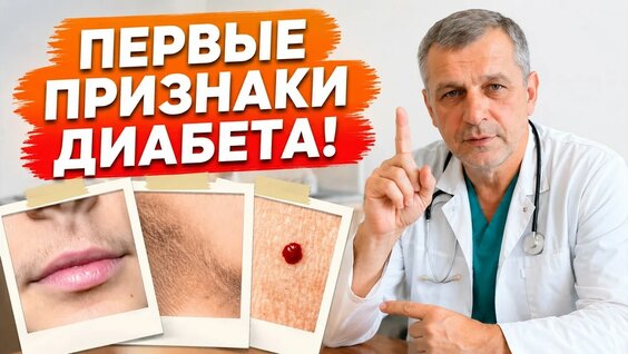 Глюкоза YouTube