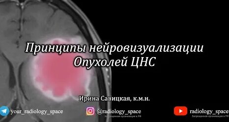 Наталья Медведева YouTube