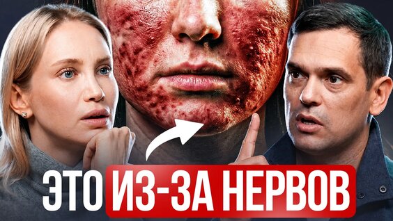 Нервы VK Видео